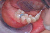 Separator - Orthodontist in Glastonbury, CT